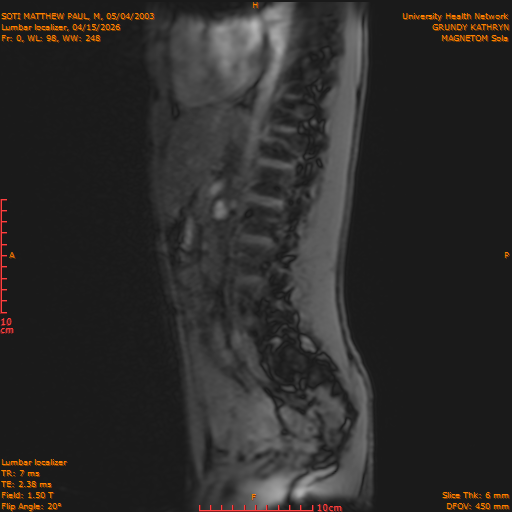 2026-04-15/Entire Spine/Lumbar Localizer/0001-IM159.png