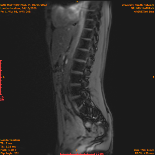 2026-04-15/Entire Spine/Lumbar Localizer/0002-IM160.png