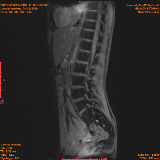 2026-04-15/Entire Spine/Lumbar Localizer/0003-IM161.png