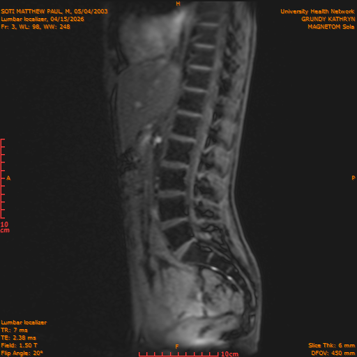 2026-04-15/Entire Spine/Lumbar Localizer/0004-IM162.png