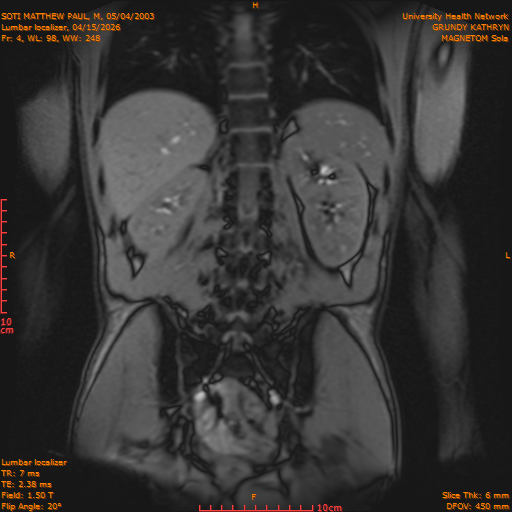 2026-04-15/Entire Spine/Lumbar Localizer/0005-IM163.png
