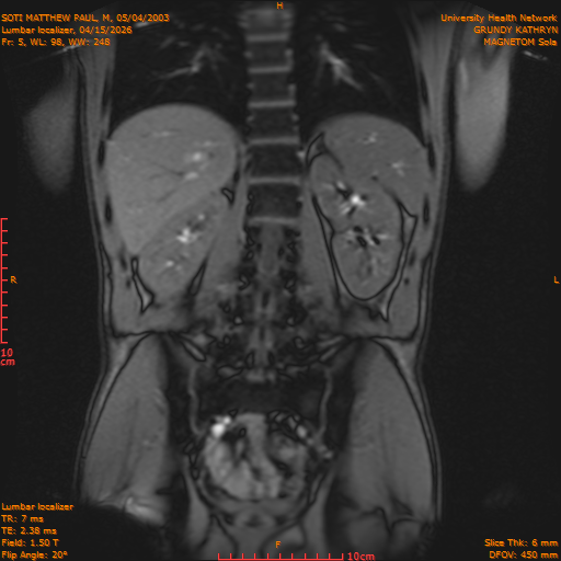2026-04-15/Entire Spine/Lumbar Localizer/0006-IM164.png