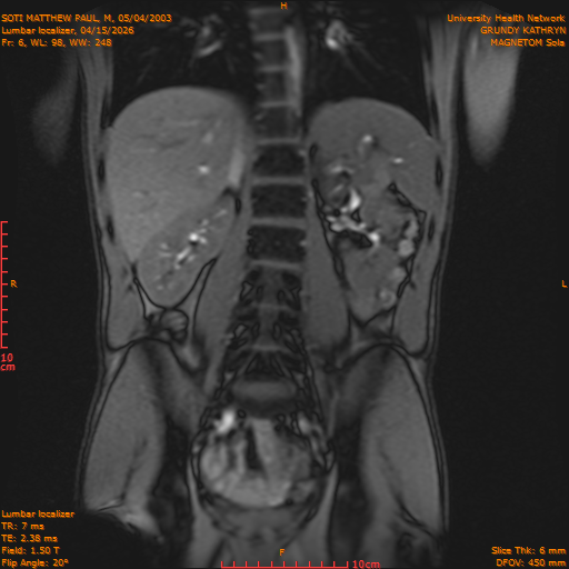 2026-04-15/Entire Spine/Lumbar Localizer/0007-IM165.png