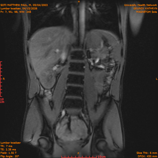 2026-04-15/Entire Spine/Lumbar Localizer/0008-IM166.png