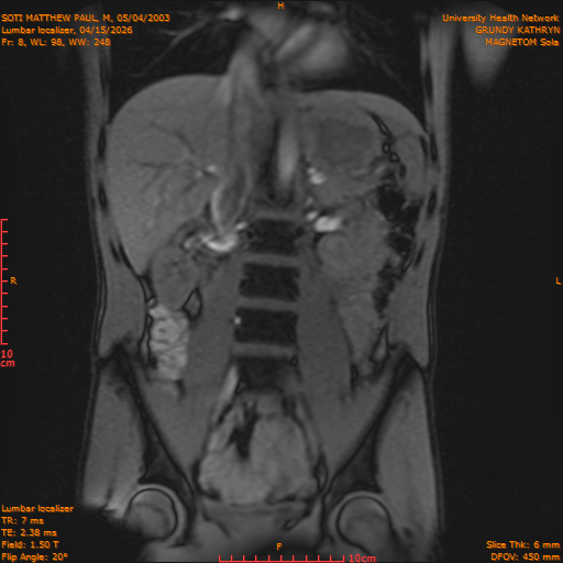 2026-04-15/Entire Spine/Lumbar Localizer/0009-IM167.png