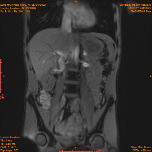 2026-04-15/Entire Spine/Lumbar Localizer/0010-IM168.png