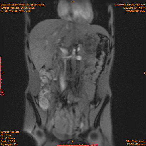 2026-04-15/Entire Spine/Lumbar Localizer/0011-IM169.png