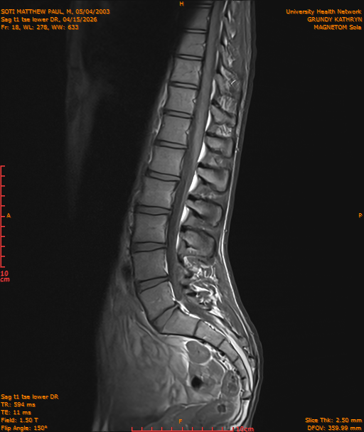 2026-04-15/Entire Spine/Sag t1 tse lower DR/0019-IM230.png