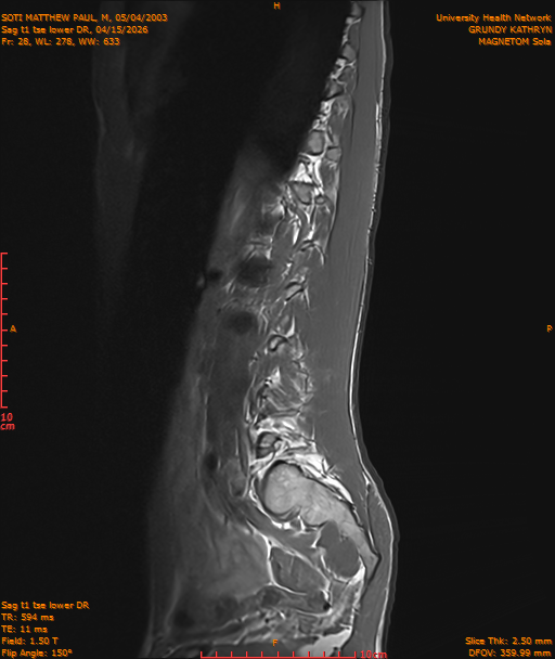 2026-04-15/Entire Spine/Sag t1 tse lower DR/0029-IM240.png