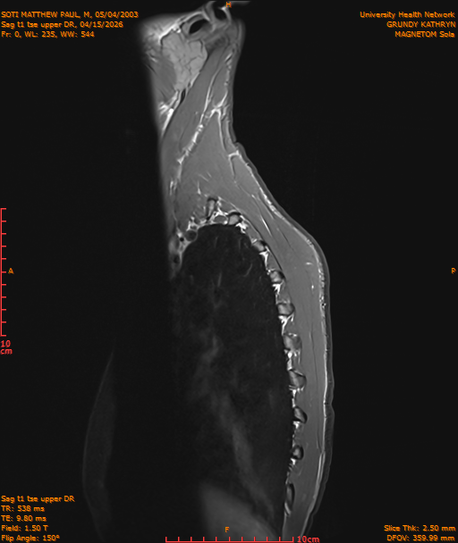 2026-04-15/Entire Spine/Sag t1 tse upper DR/0001-IM174.png