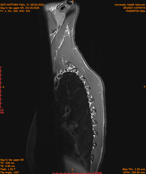 2026-04-15/Entire Spine/Sag t1 tse upper DR/0002-IM175.png