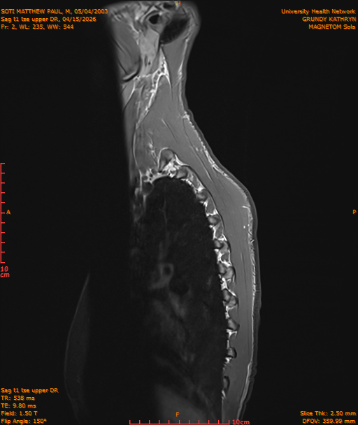 2026-04-15/Entire Spine/Sag t1 tse upper DR/0003-IM176.png