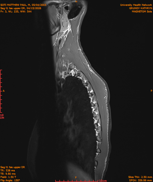 2026-04-15/Entire Spine/Sag t1 tse upper DR/0004-IM177.png