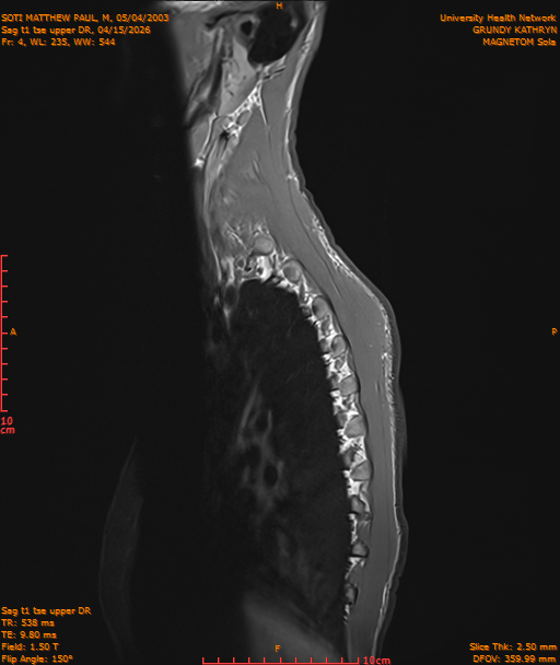 2026-04-15/Entire Spine/Sag t1 tse upper DR/0005-IM178.png