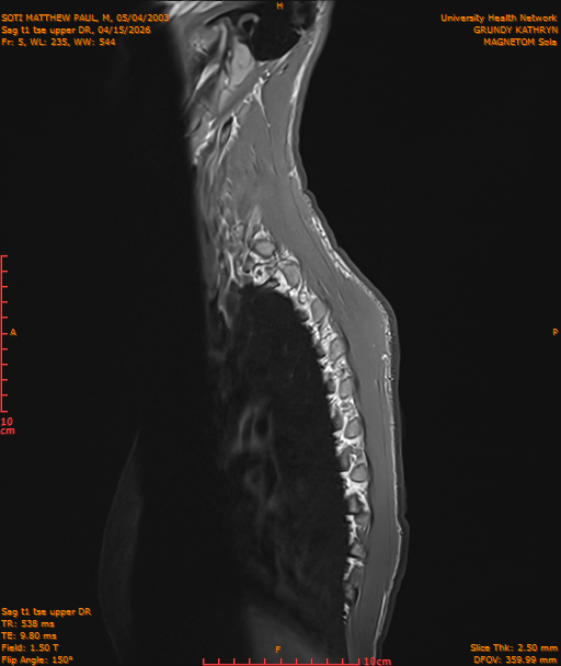 2026-04-15/Entire Spine/Sag t1 tse upper DR/0006-IM179.png