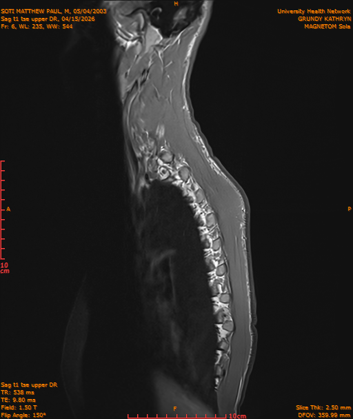 2026-04-15/Entire Spine/Sag t1 tse upper DR/0007-IM180.png