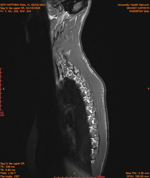 2026-04-15/Entire Spine/Sag t1 tse upper DR/0008-IM181.png