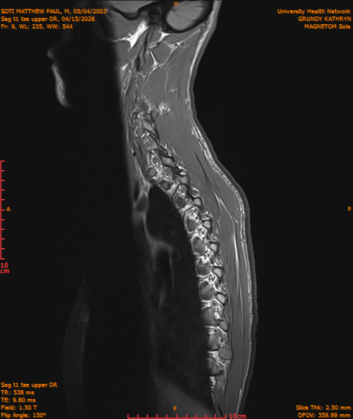 2026-04-15/Entire Spine/Sag t1 tse upper DR/0010-IM183.png
