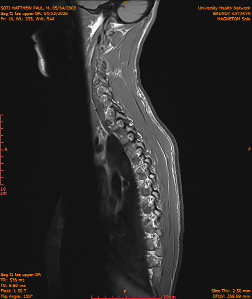 2026-04-15/Entire Spine/Sag t1 tse upper DR/0011-IM184.png