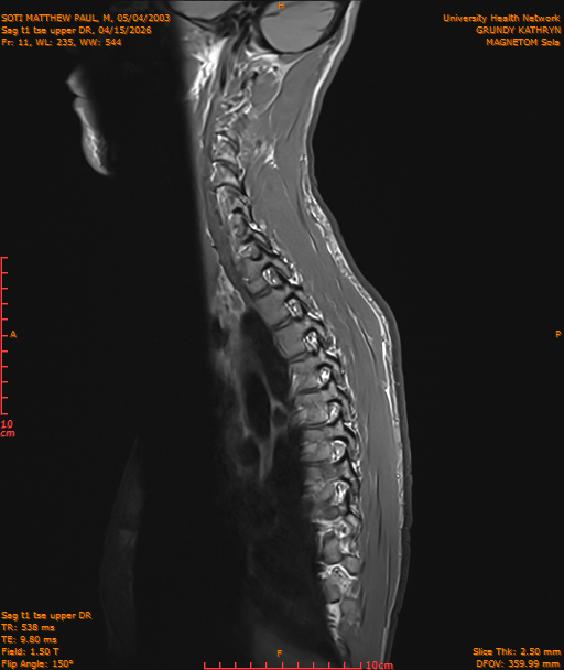 2026-04-15/Entire Spine/Sag t1 tse upper DR/0012-IM185.png
