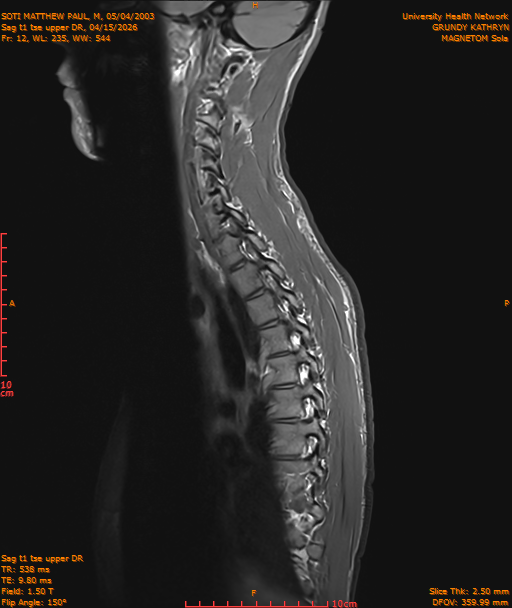 2026-04-15/Entire Spine/Sag t1 tse upper DR/0013-IM186.png