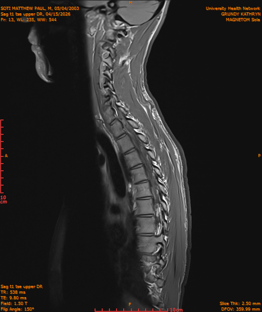 2026-04-15/Entire Spine/Sag t1 tse upper DR/0014-IM187.png