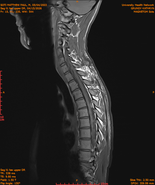 2026-04-15/Entire Spine/Sag t1 tse upper DR/0016-IM189.png