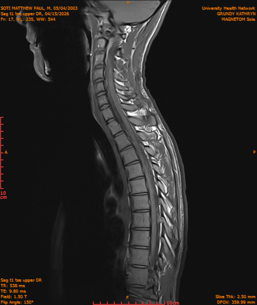 2026-04-15/Entire Spine/Sag t1 tse upper DR/0018-IM191.png