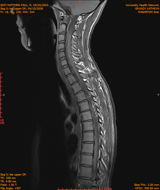 2026-04-15/Entire Spine/Sag t1 tse upper DR/0019-IM192.png