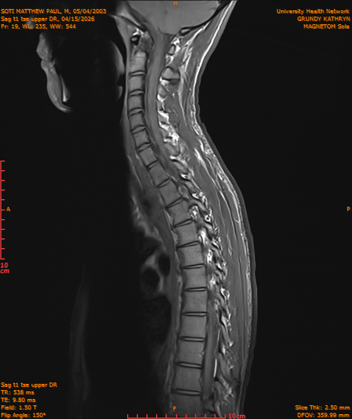 2026-04-15/Entire Spine/Sag t1 tse upper DR/0020-IM193.png