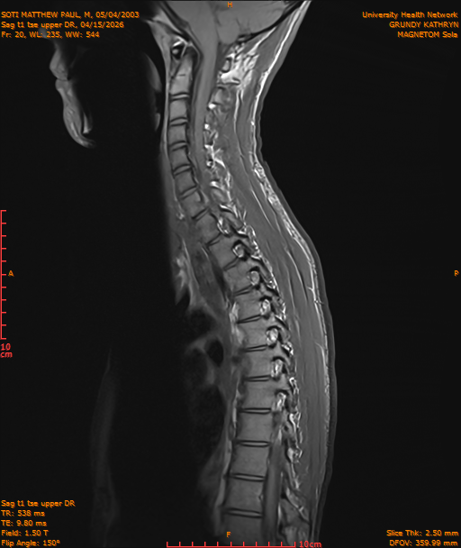2026-04-15/Entire Spine/Sag t1 tse upper DR/0021-IM194.png