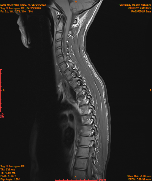 2026-04-15/Entire Spine/Sag t1 tse upper DR/0022-IM195.png