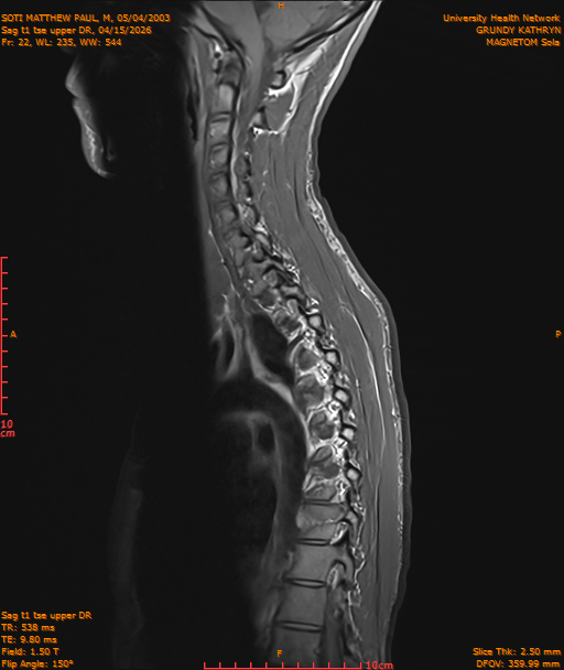 2026-04-15/Entire Spine/Sag t1 tse upper DR/0023-IM196.png