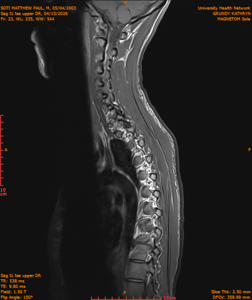2026-04-15/Entire Spine/Sag t1 tse upper DR/0024-IM197.png