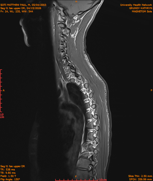 2026-04-15/Entire Spine/Sag t1 tse upper DR/0025-IM198.png