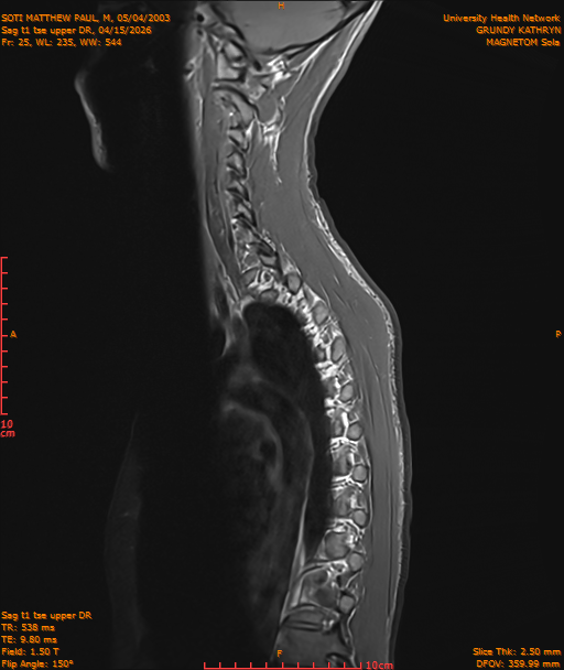 2026-04-15/Entire Spine/Sag t1 tse upper DR/0026-IM199.png
