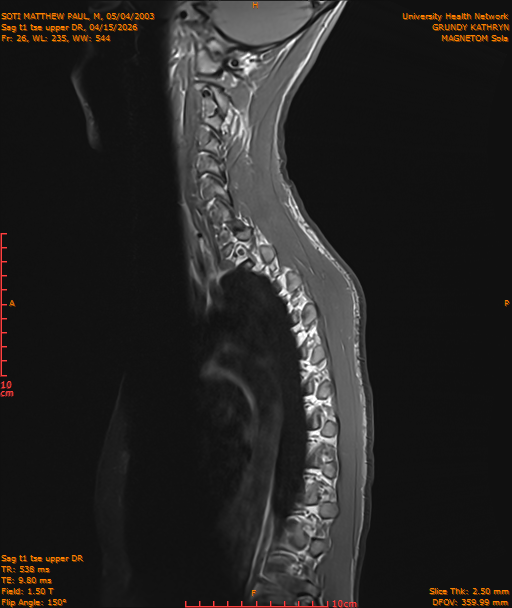 2026-04-15/Entire Spine/Sag t1 tse upper DR/0027-IM200.png