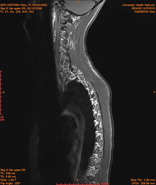 2026-04-15/Entire Spine/Sag t1 tse upper DR/0028-IM201.png