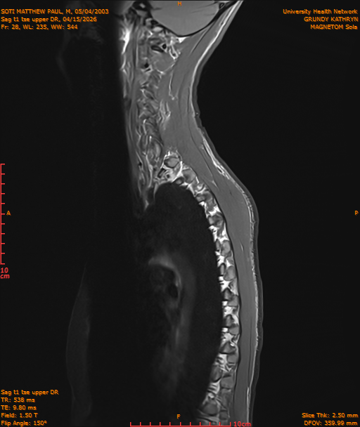2026-04-15/Entire Spine/Sag t1 tse upper DR/0029-IM202.png