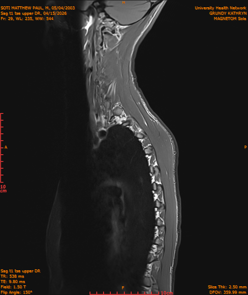 2026-04-15/Entire Spine/Sag t1 tse upper DR/0030-IM203.png