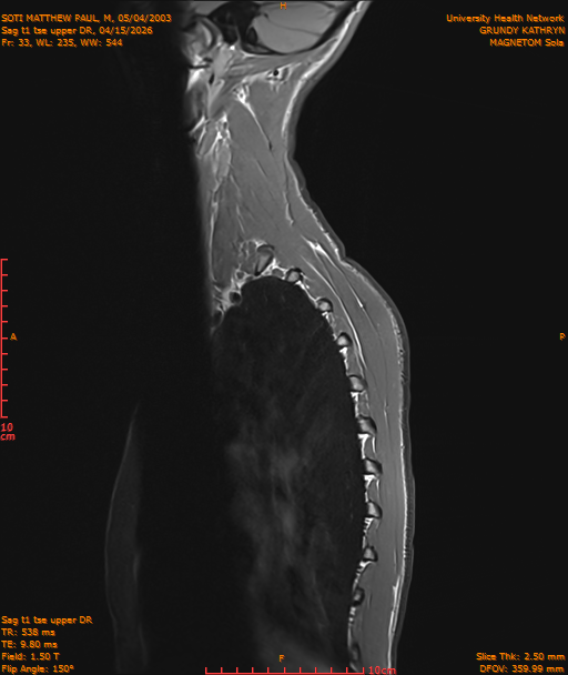 2026-04-15/Entire Spine/Sag t1 tse upper DR/0034-IM207.png
