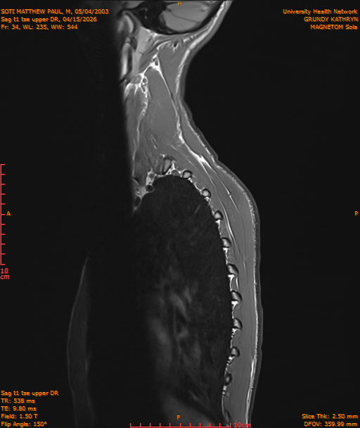 2026-04-15/Entire Spine/Sag t1 tse upper DR/0035-IM208.png