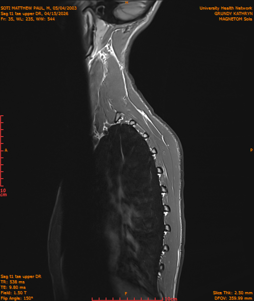 2026-04-15/Entire Spine/Sag t1 tse upper DR/0036-IM209.png