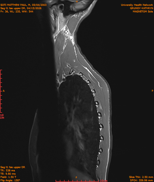 2026-04-15/Entire Spine/Sag t1 tse upper DR/0037-IM210.png