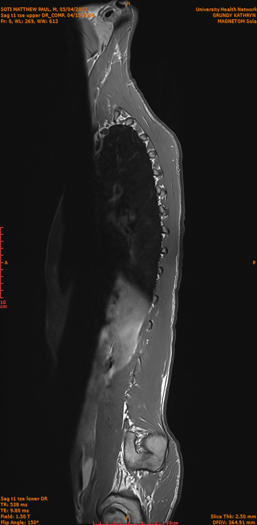 2026-04-15/Entire Spine/Sag t1 tse upper DR_COMP/0001-IM250.png