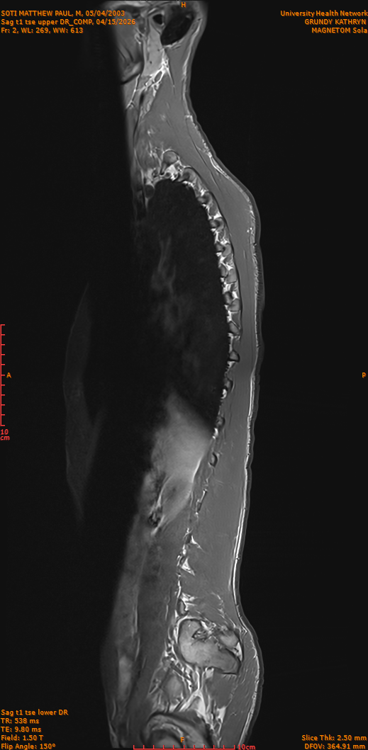 2026-04-15/Entire Spine/Sag t1 tse upper DR_COMP/0003-IM252.png