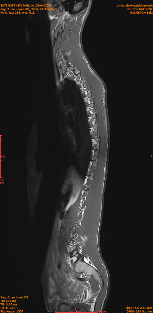 2026-04-15/Entire Spine/Sag t1 tse upper DR_COMP/0007-IM256.png