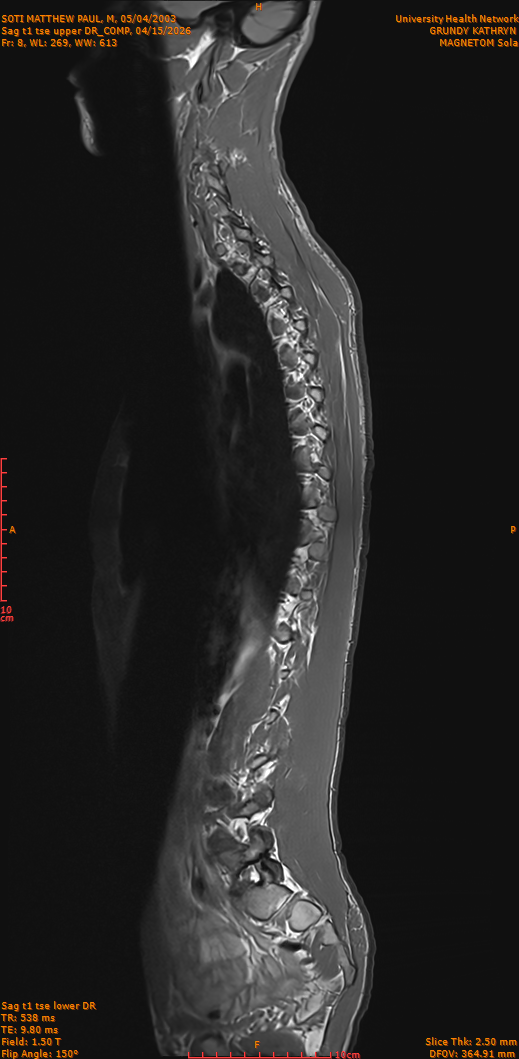 2026-04-15/Entire Spine/Sag t1 tse upper DR_COMP/0009-IM258.png