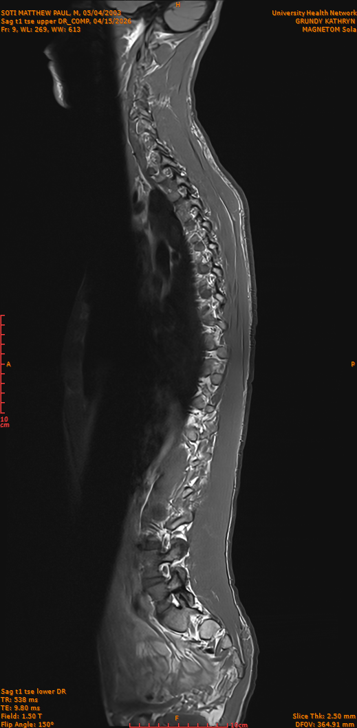 2026-04-15/Entire Spine/Sag t1 tse upper DR_COMP/0010-IM259.png