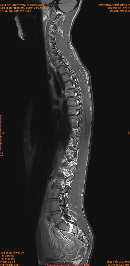 2026-04-15/Entire Spine/Sag t1 tse upper DR_COMP/0012-IM261.png